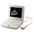 凯信笔记本式超声诊断仪KX5000